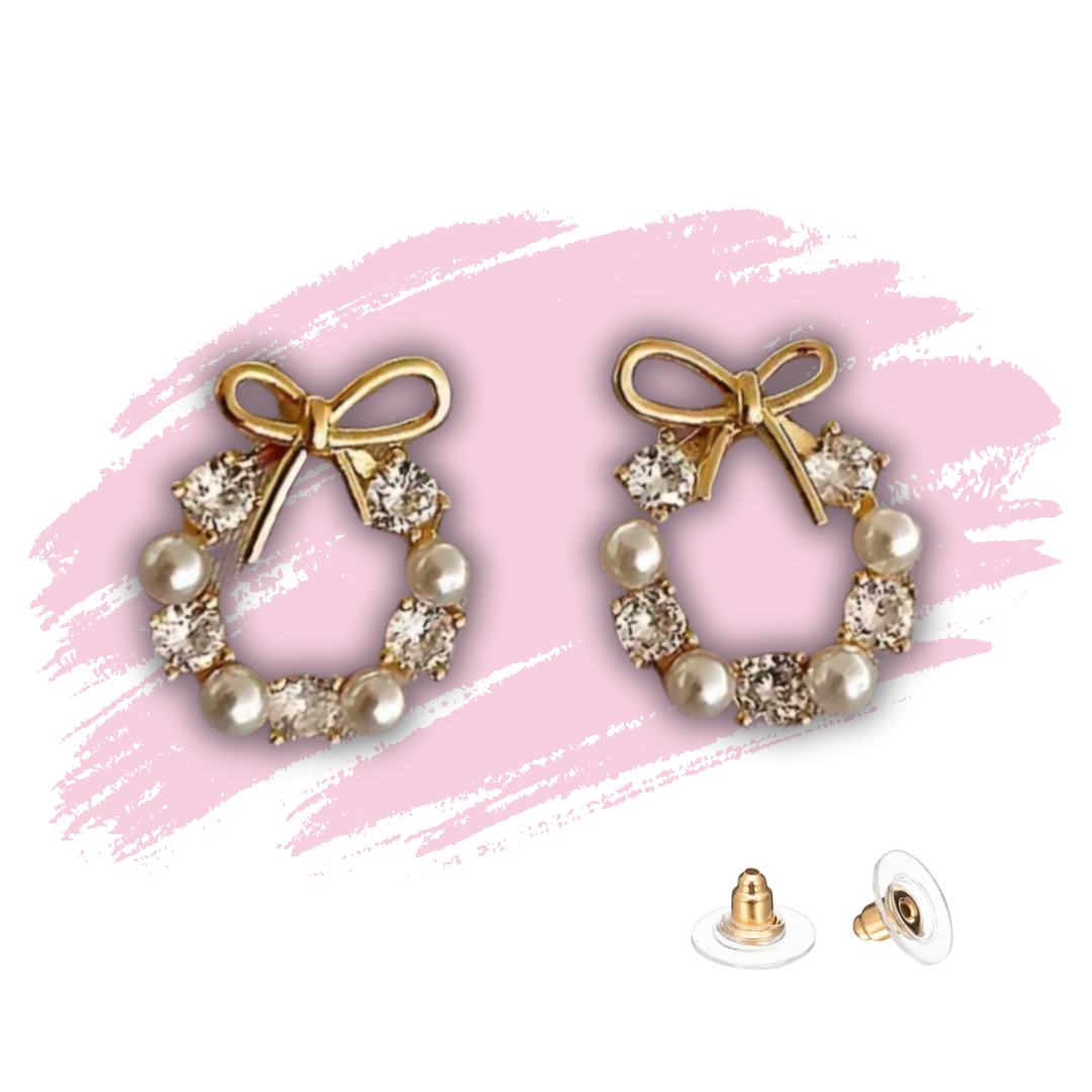 Aretes